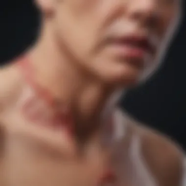 Clinical Presentations of Advanced Esophageal Cancer Chart showing clinical presentations of advanced esophageal cancer