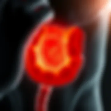 Diagram showing the stages of anorectal squamous cell carcinoma progression