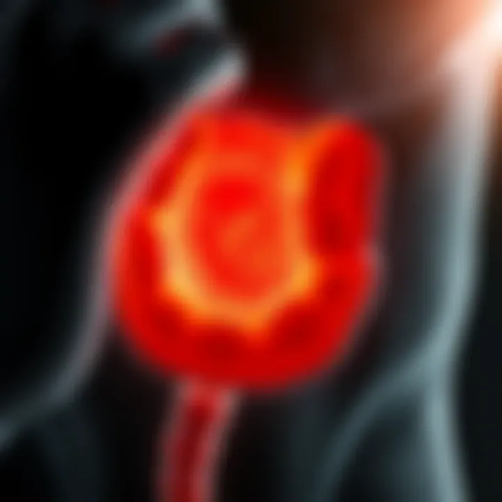 Diagram showing the stages of anorectal squamous cell carcinoma progression