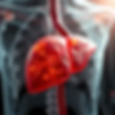 Inflammation of the Liver in Autoimmune Hepatitis Detailed illustration of liver inflammation due to autoimmune hepatitis