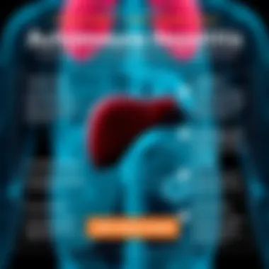 Treatment Options for Autoimmune Hepatitis Infographic summarizing treatment options for autoimmune hepatitis