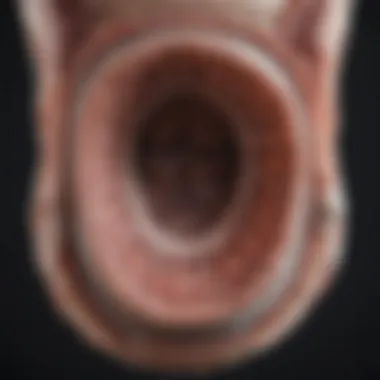 Potential Findings from Colon Cat Scans Graphical depiction of potential findings from a colon cat scan