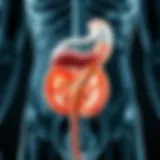 Diagram of ileal pouch anatomy