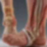 Anatomical diagram showing the plantar fascia and Achilles tendon.