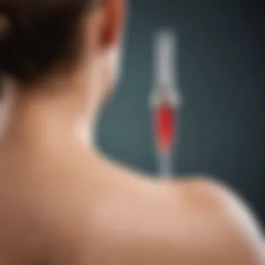 Cortisone Injection Technique for Shoulder Treatment Illustration depicting cortisone injection into the shoulder