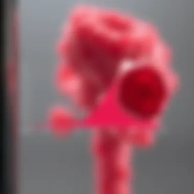 Graph depicting progression from MGUS to multiple myeloma