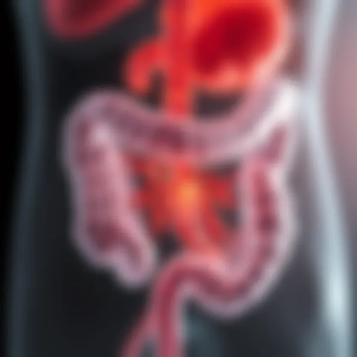 Illustration of the gut microbiome with L Rhamnosus highlighted