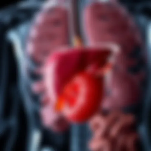 Understanding Liver Anatomy and Abscesses Illustration of liver anatomy highlighting abscess formation