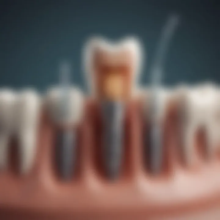 Illustration showing types of teeth irrigation systems