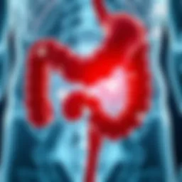 Illustration of the sigmoid colon affected by ulcerative colitis
