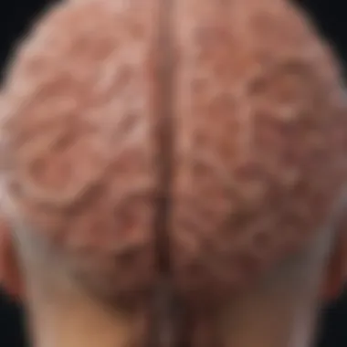 Neurological Manifestations of Wilson's Disease Neurological impact of copper accumulation