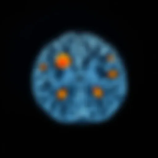 Visualizing MS Lesions on MRI Cross-sectional MRI scan highlighting MS lesions