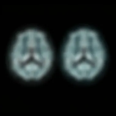 Comparison of T1 and T2 weighted MRI scans in MS diagnosis