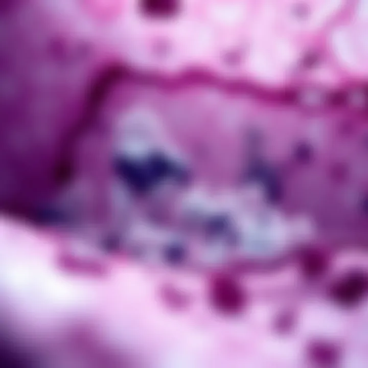 Microscopic Analysis of Amyloid Deposits Microscopic view of amyloid deposits in tissue