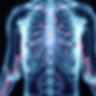 Pathophysiology of Light Chain Amyloidosis Diagram illustrating the pathophysiology of light chain amyloidosis