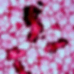 Microscopic view of lung tissue affected by cancer