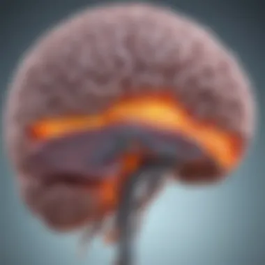 Pathways of Melanoma Metastasis to the Brain Diagram showing the pathways of melanoma metastasis to the brain
