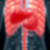 Metastatic Pathways of Gallbladder Cancer Detailed diagram illustrating the metastatic pathways of gallbladder cancer