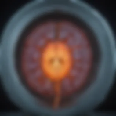 MRI Imaging in Multiple Sclerosis Diagnosis MRI scan showcasing MS lesions