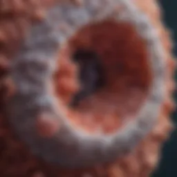 Microscopic view of squamous cell carcinoma in lung tissue