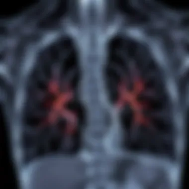 Imaging of Lung Metastases Radiographic imaging showing lung metastases from renal cell carcinoma