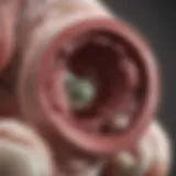 Illustration depicting the location of fibroids within the uterus