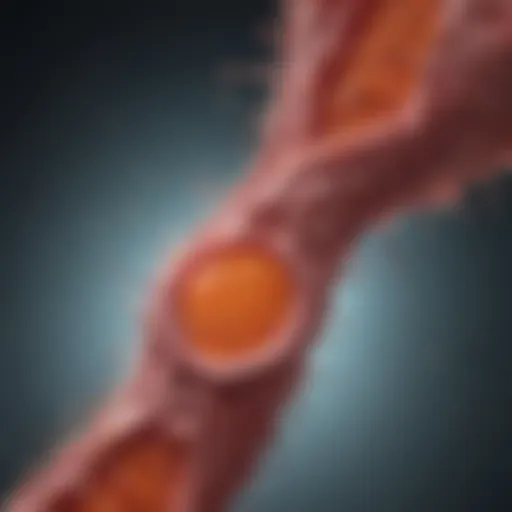 Diagram illustrating the pathophysiology of advanced Acute Myeloid Leukemia