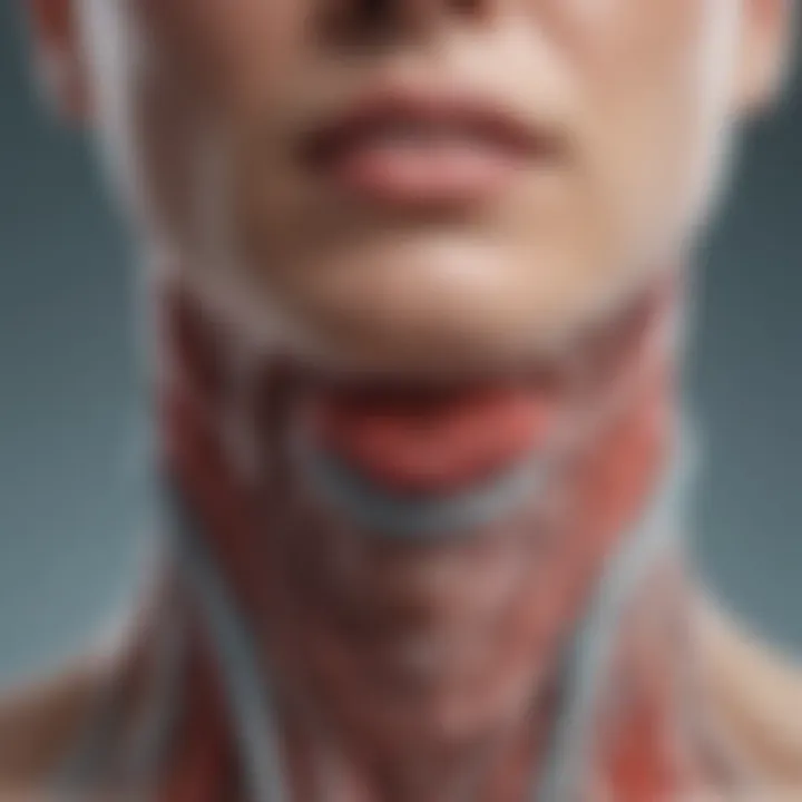 Diagram illustrating Hashimoto's thyroiditis pathophysiology