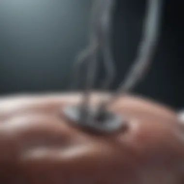 Essential Surgical Tools for Hernia Repair Surgical equipment setup for hernia repair