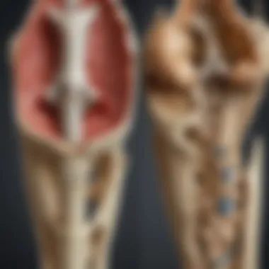 Diagram illustrating the anatomy of healthy versus osteoporotic bones