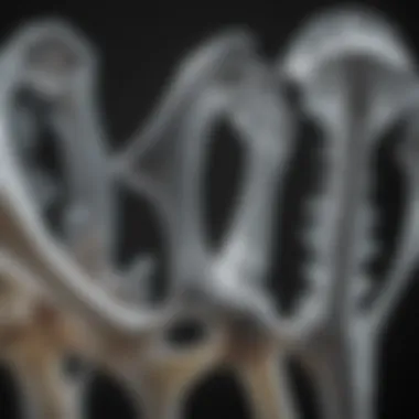 X-ray of Osteoporotic Bones X-ray showing osteoporotic changes in bone structure