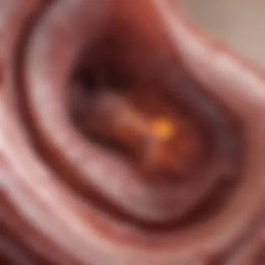 Cystic Lesions in Kidney Tissue Illustration of cystic lesions in kidney tissue