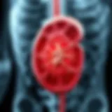 Illustration depicting the anatomy of the kidney affected by renal cell carcinoma