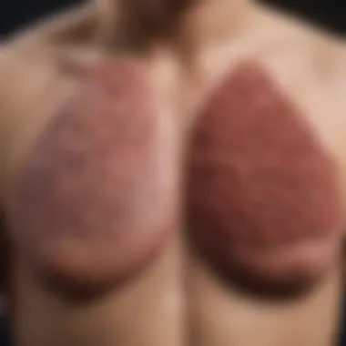 Treatment Modalities for Lung Cancer Chart showing treatment options for lung cancer subtypes